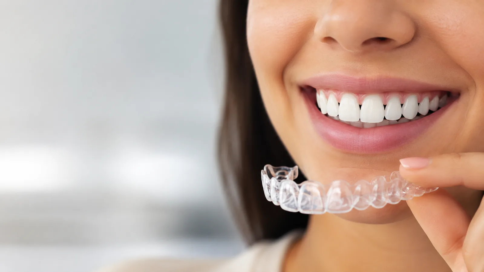 MDRN Dental Studio educational image for Black Triangles Between Teeth: Why Aligners Alone May Not Fix Them