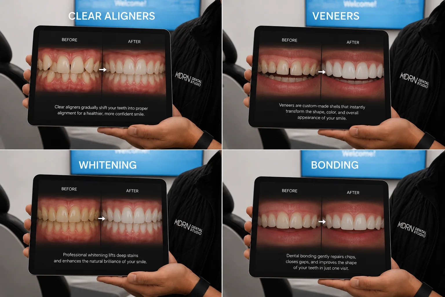 MDRN Dental Studio cosmetic dentistry visual comparing clear aligners, veneers, whitening, and bonding