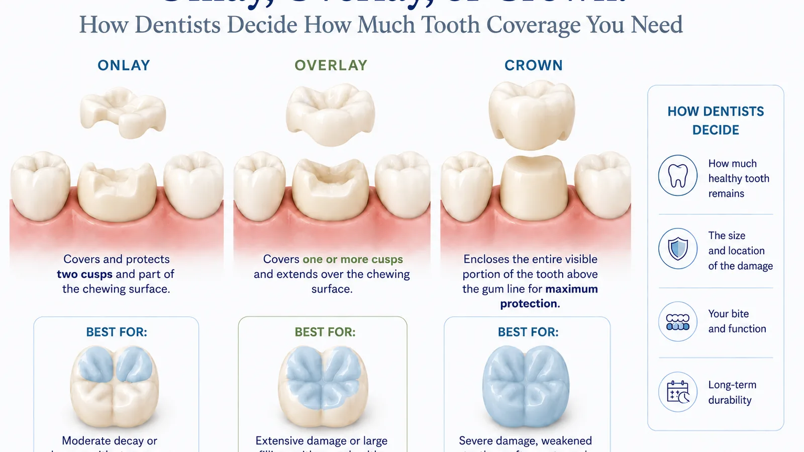 MDRN Dental Studio educational image for Onlay, Overlay, or Crown: How Dentists Decide How Much Tooth Coverage You Need