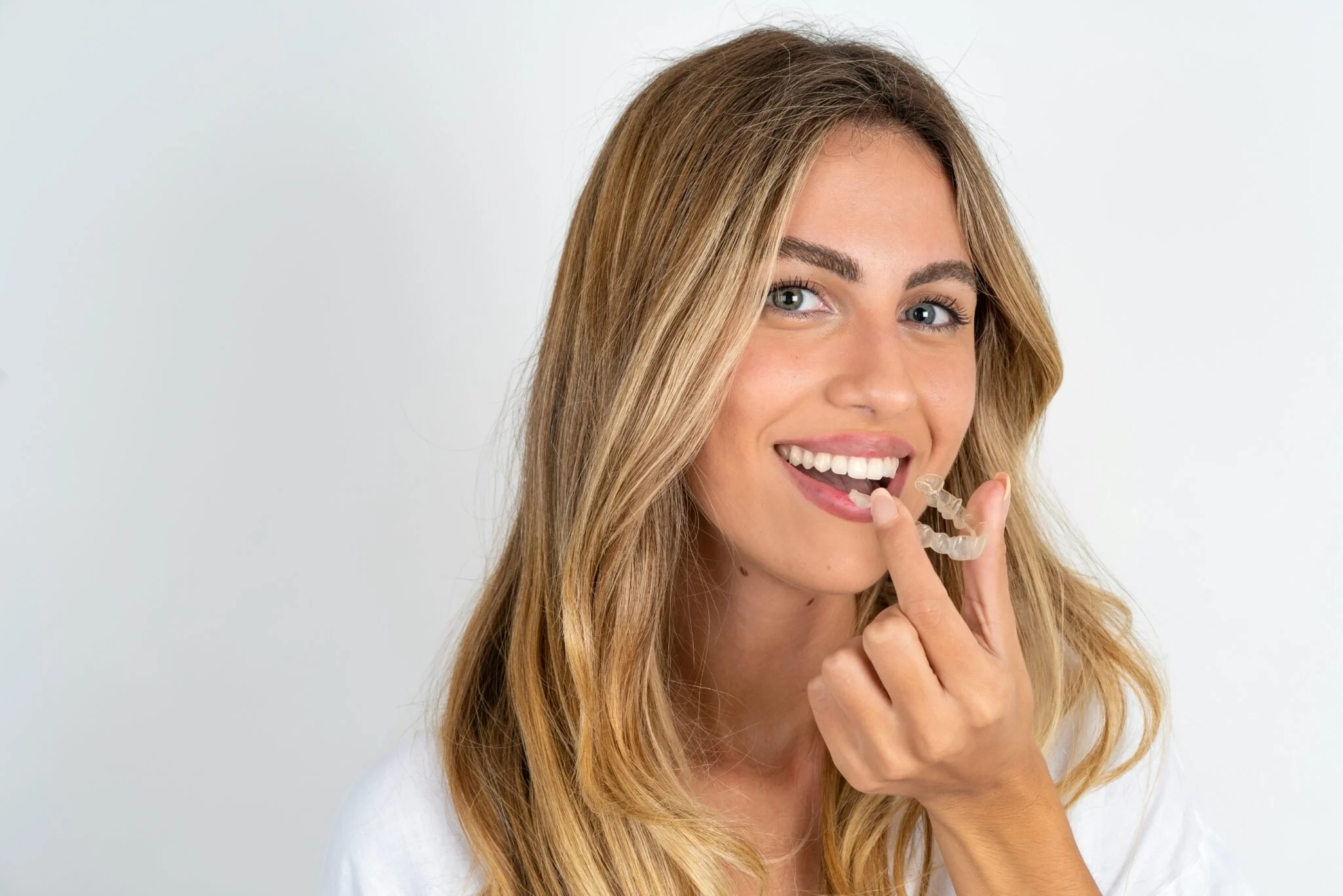 Clear aligner trays at MDRN Dental Studio in McKinney, TX